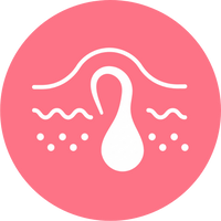 Fini les poils incarnés